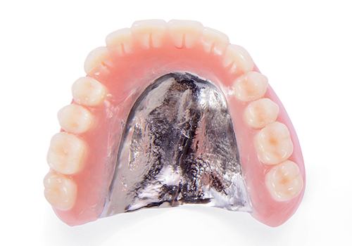 自由診療の総入れ歯：金属床